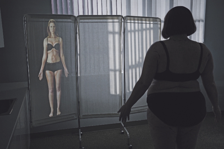 „Alicia „Plum“ Kettle imaginiert ihren postoperativen Körper in der Serie Dietland. Pressefoto Amazon